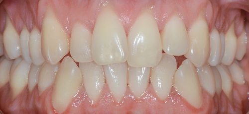 Case 1 - Before