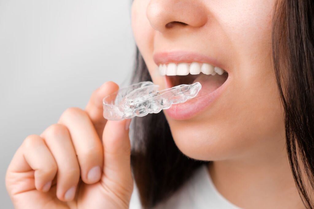 custom made transparent Invisalign aligner