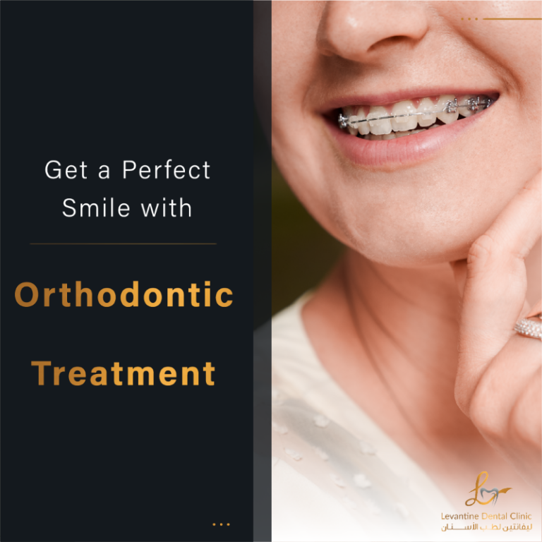 Orthodontic treatment