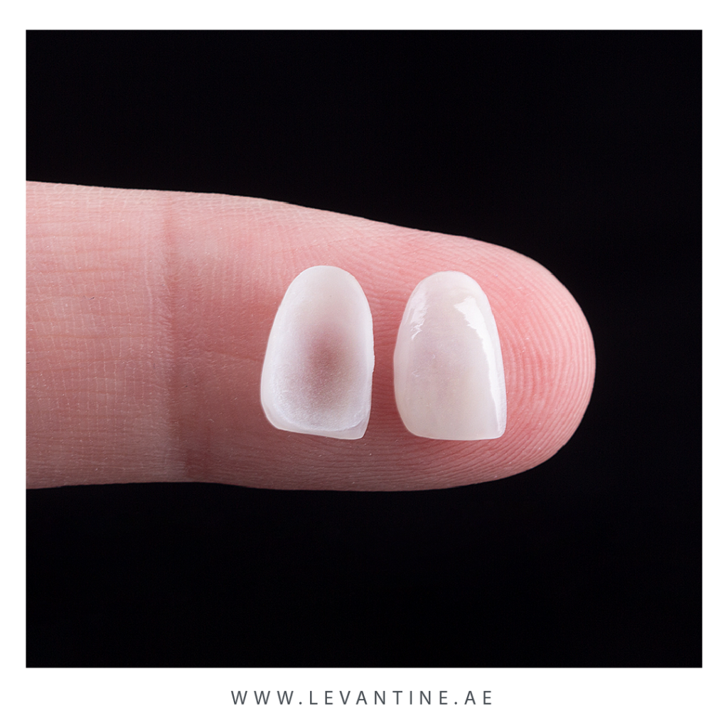 porcelain veneers Dental Veneers