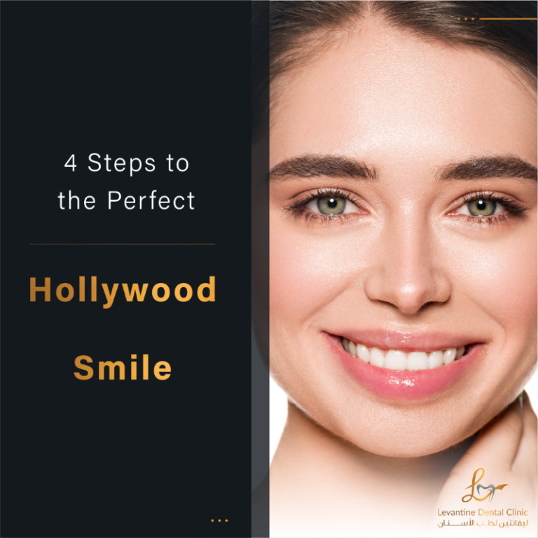 Hollywood Smile