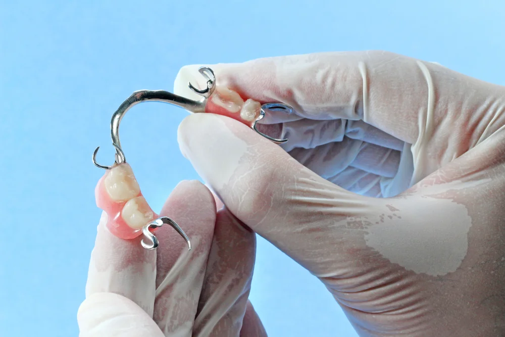 Removable Dentures at Levantine Dental Clinic