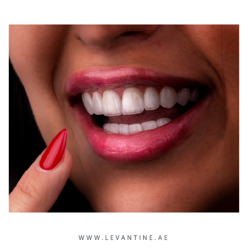best dental veneers clinic in dubai Dental Veneers