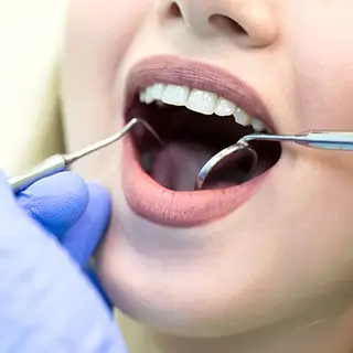 Preventive-Dentistry