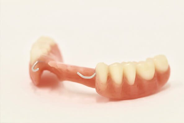 انواع اطقم الأسنان - طقم أسنان حزئي