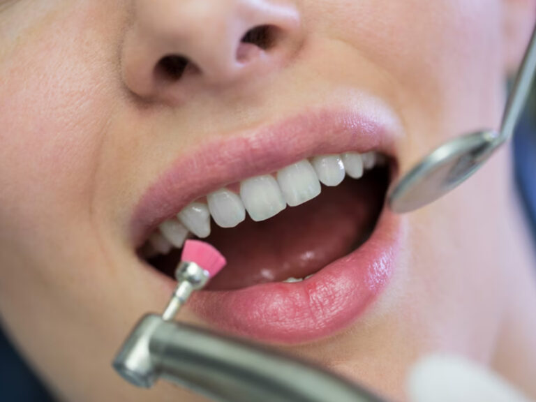 healthy teeth - best dental clinic in dubai