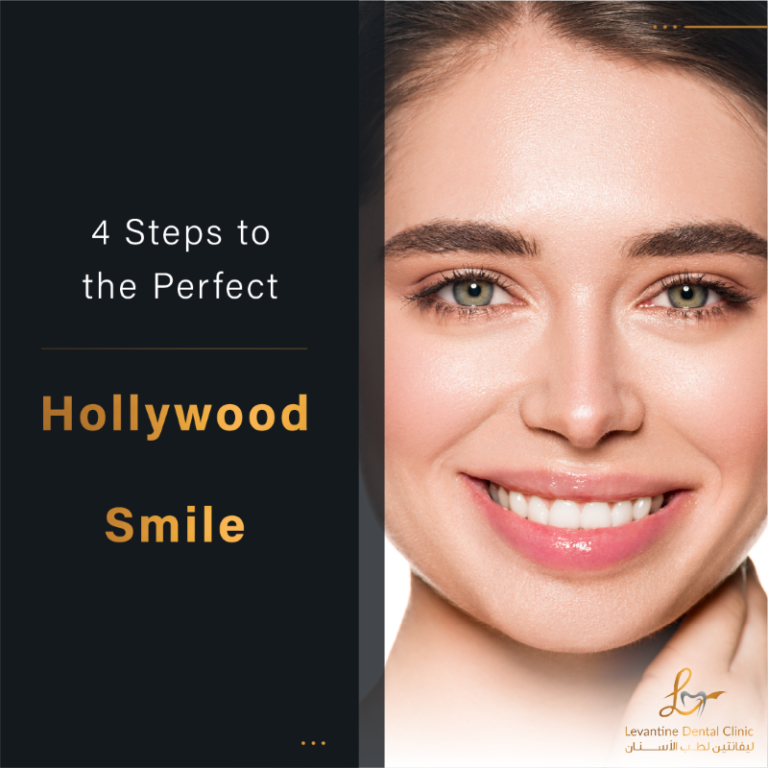 4 Steps to the Perfect Hollywood Smile