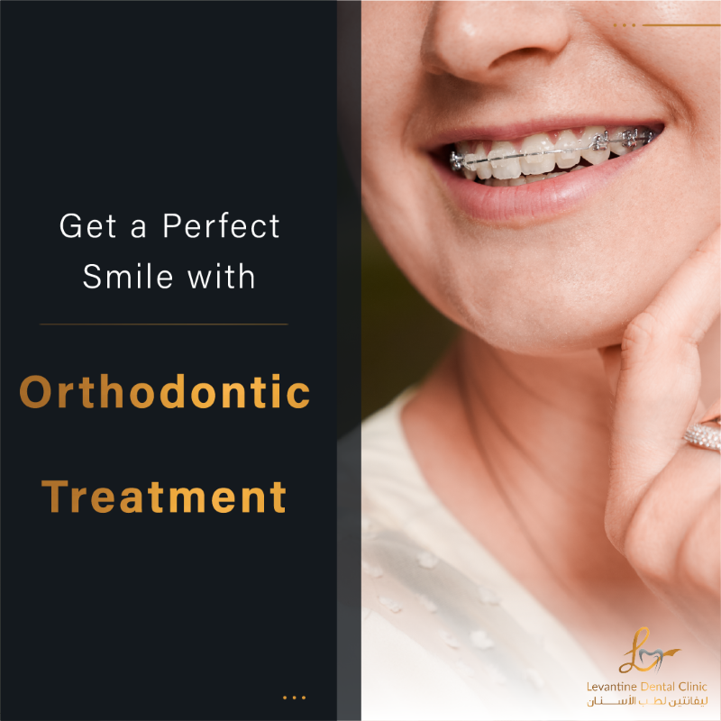 Get a Perfect Smile with Orthodontic Treatment