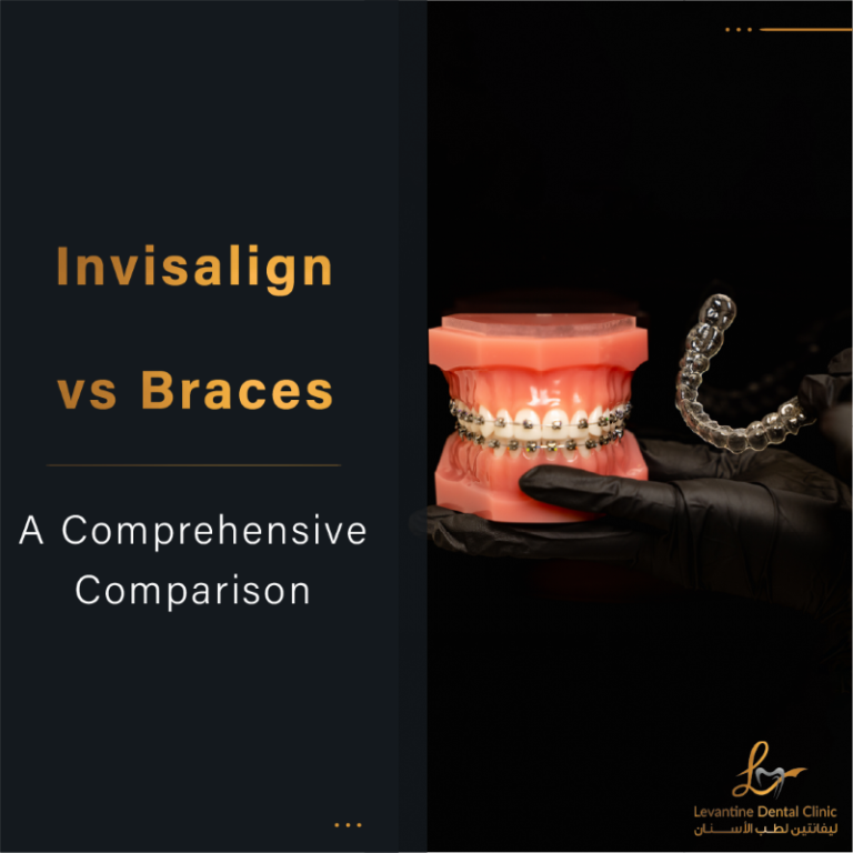 Invisalign vs Braces A Comprehensive Comparison