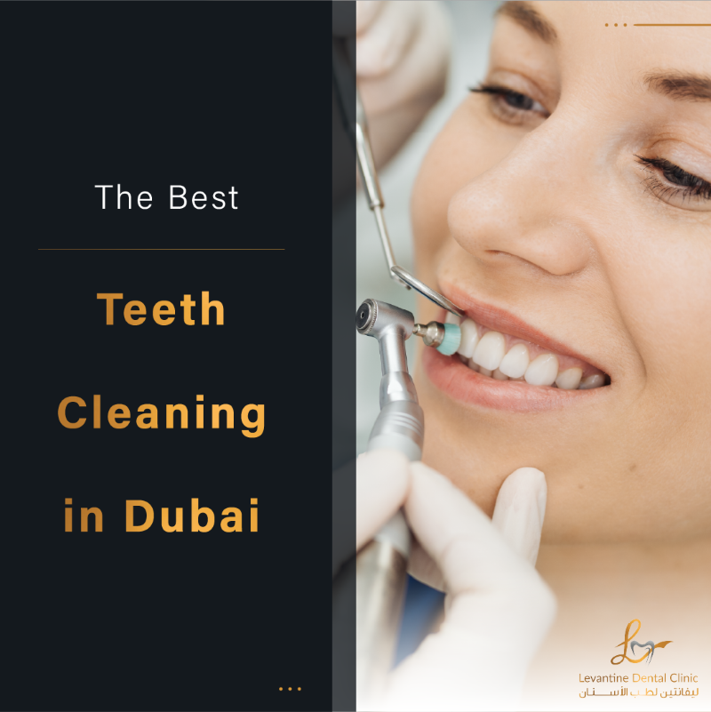 The Best Teeth Cleaning in Dubai