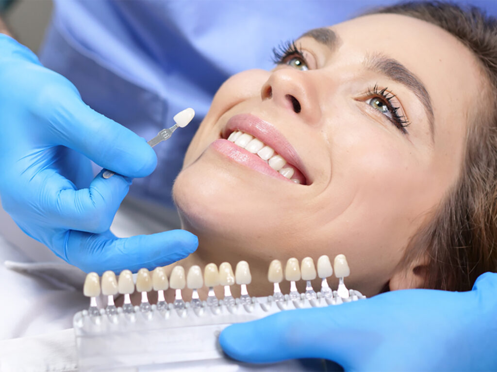 lifespan of veneers - best dental clinic in dubai