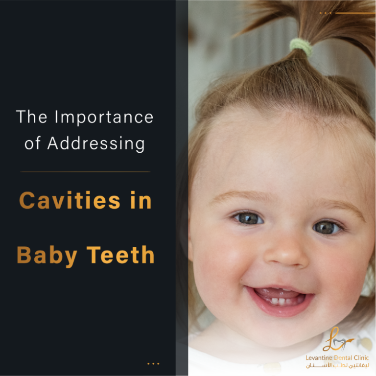 The Importance of Addressing Cavities in Baby Teeth
