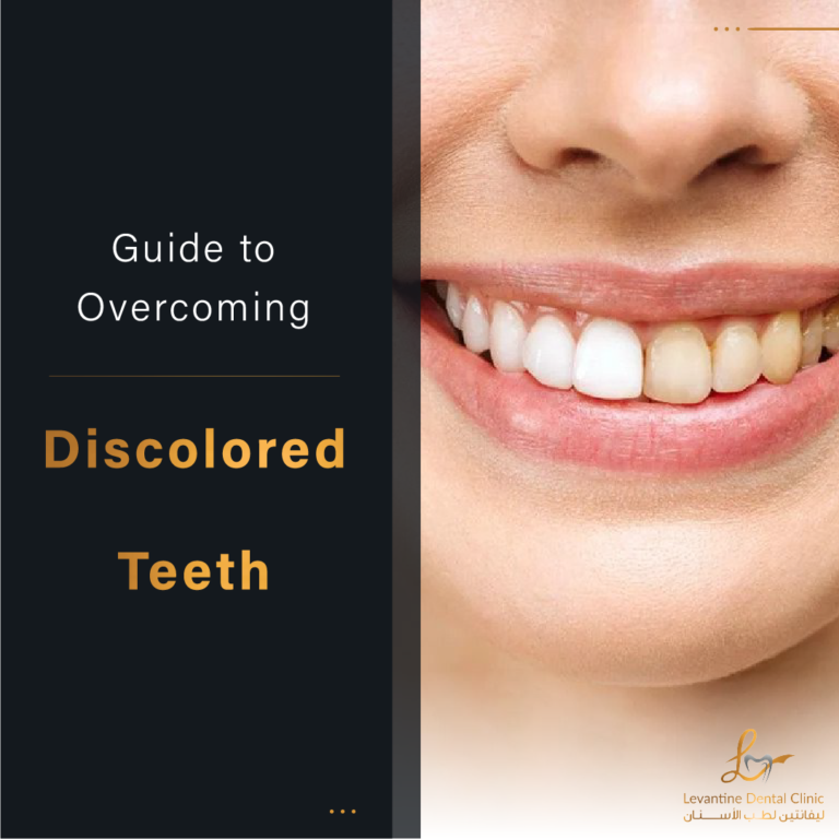 Comprehensive Guide to Overcoming Discolored Teeth