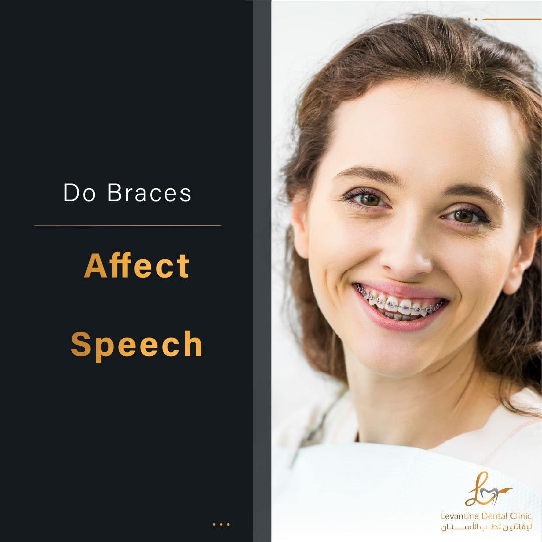 Do Braces Affect Speech? Uncovering The Reality