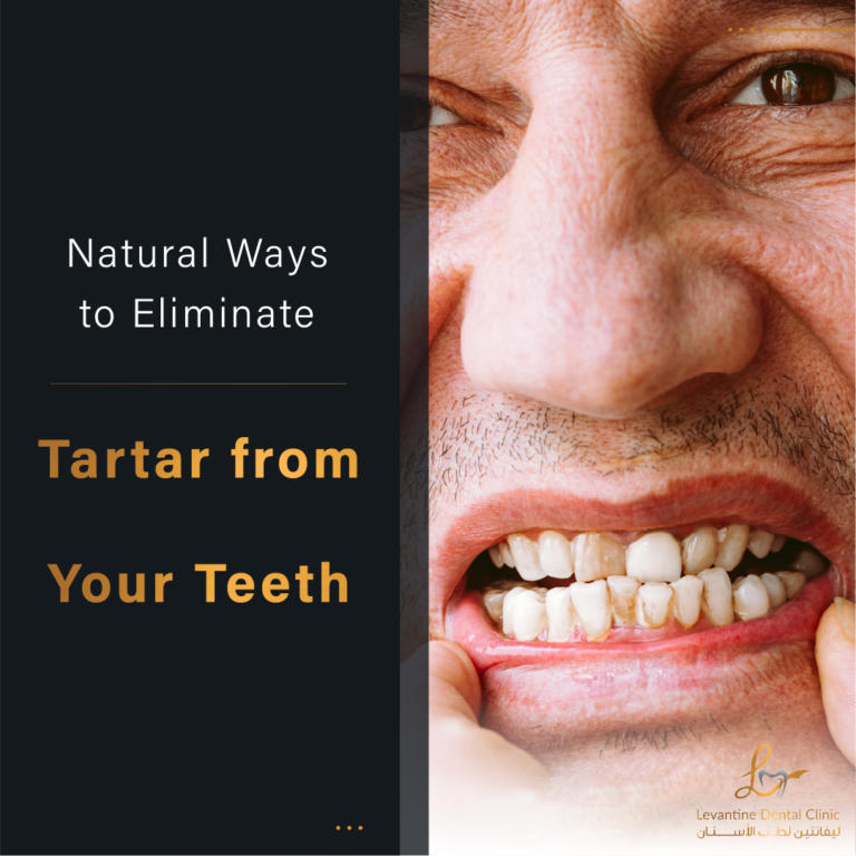 Effective Natural Ways to Eliminate Tartar from Your Teeth