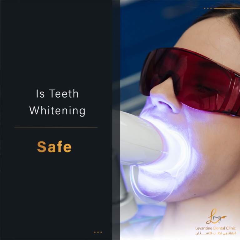Is Teeth Whitening Safe