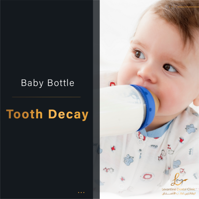 Preventing Baby Bottle Tooth Decay