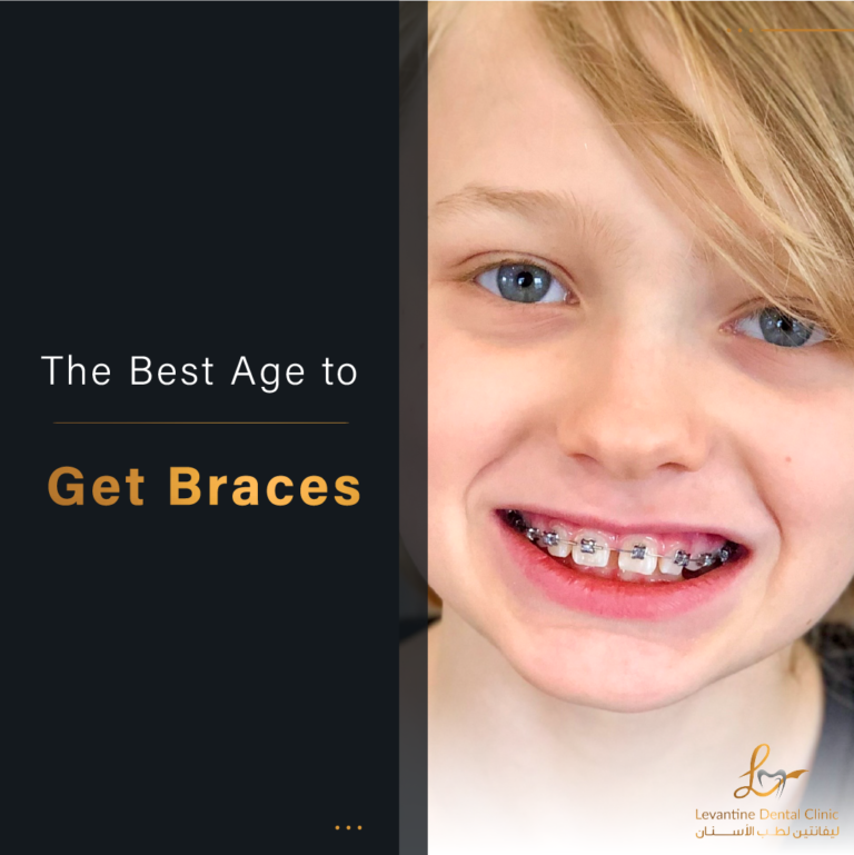 The Best Age to Get Braces Expert Recommendations and Insights blog