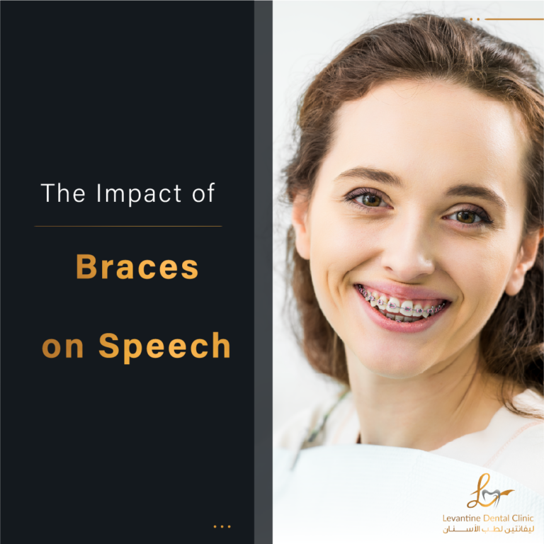 The Impact of Braces on Speech Debunking Misconceptions
