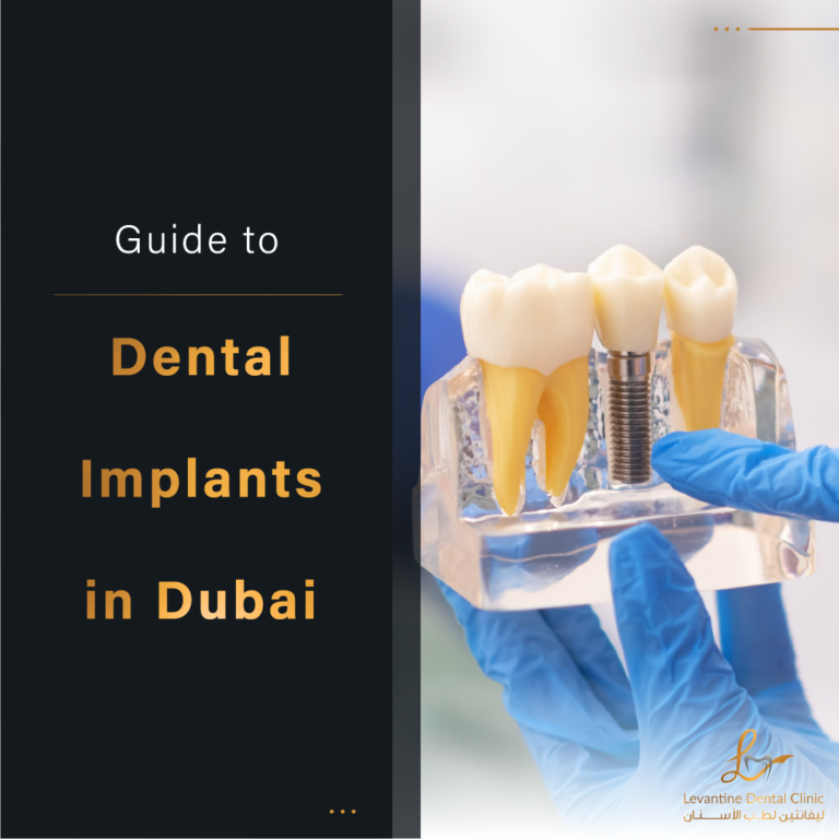 The Ultimate Guide to Dental Implants in Dubai Cost, Benefits, and Everything You Need to Know