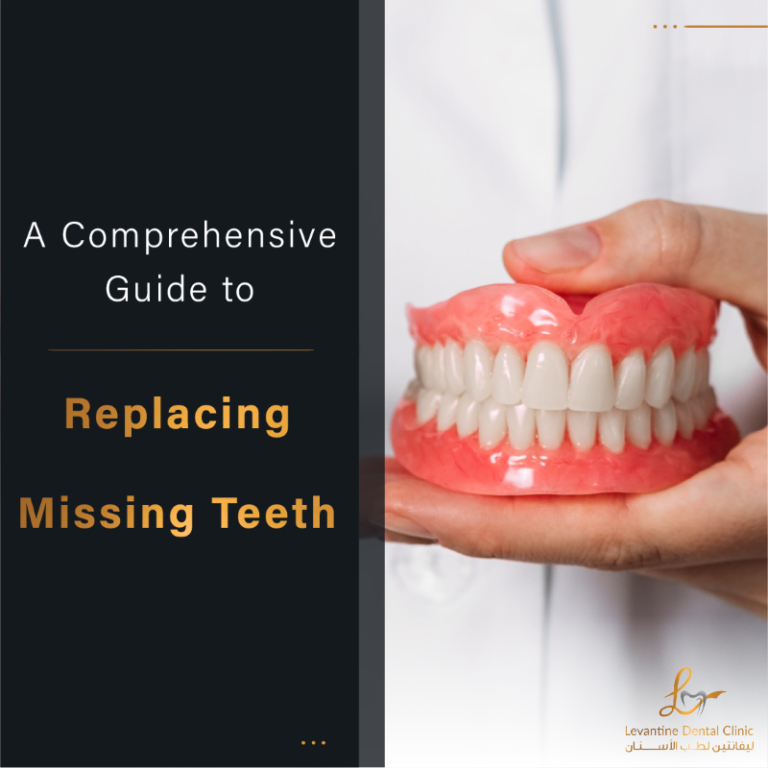 Understanding Dentures A Comprehensive Guide to Replacing Missing Teeth