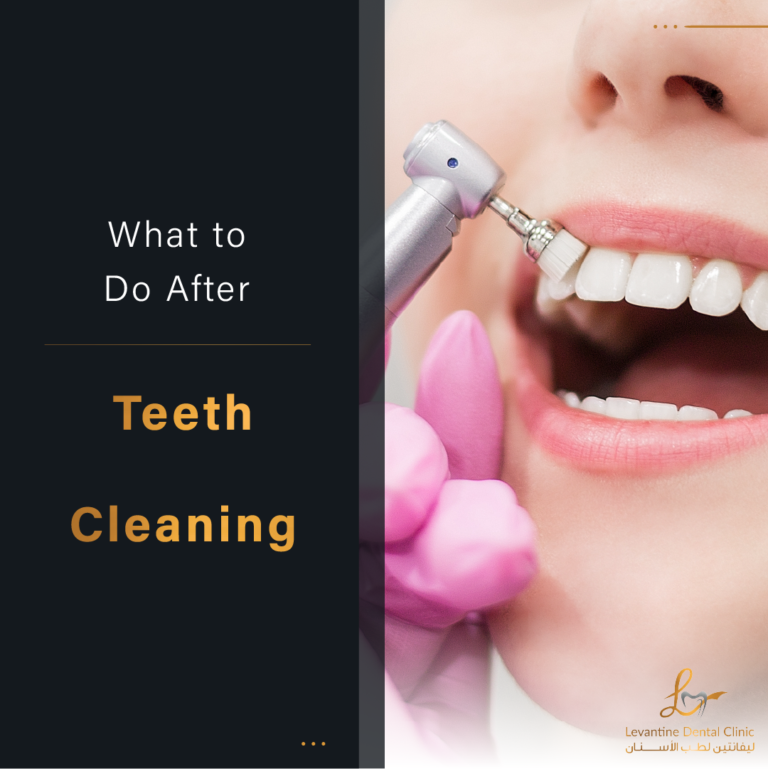 What to Do After Teeth Cleaning The Ultimate Guide
