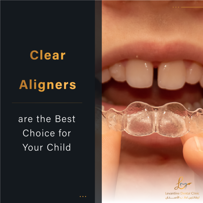 Why Clear Aligners are the Best Choice for Your Child’s Orthodontic Treatment