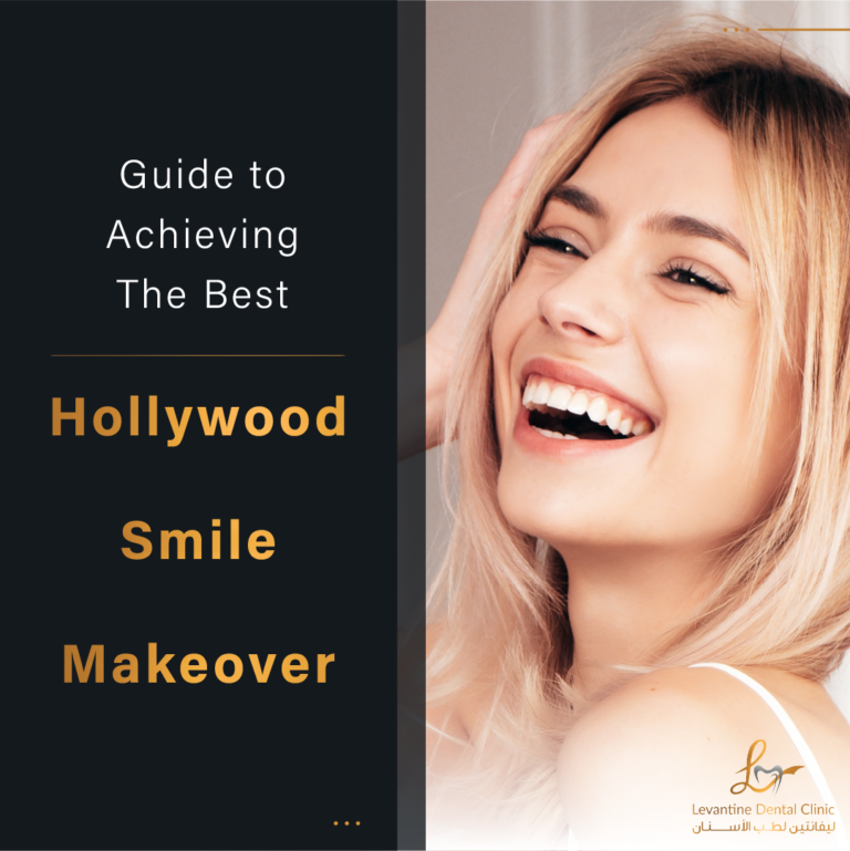Your Ultimate Guide to Achieving The Best Hollywood Smile Makeover