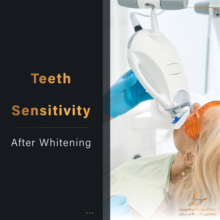 tooth sensitivity after whitening