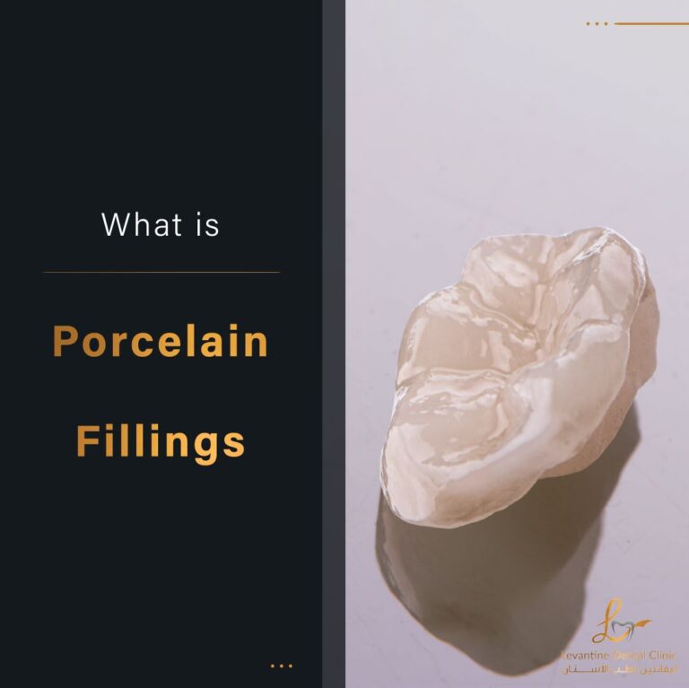 what is porcelain Fillings